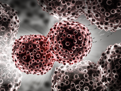 NCCN Guidelines