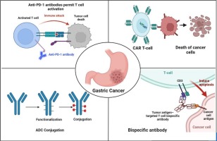 Current progress and challenges of immunotherapy in gastric cancer: A focus on CAR-T cells therapeutic approach