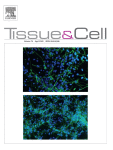 Binding of pleiotrophin to cell surface nucleolin mediates prostate cancer cell adhesion to osteoblasts