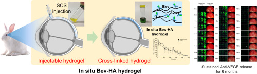 Six-month sustained delivery of anti-VEGF from in-situ forming hydrogel in the suprachoroidal space
