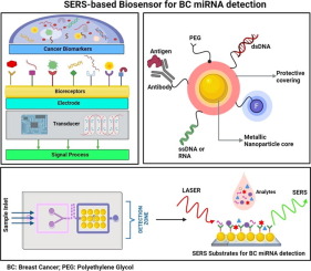 Surface-enhanced Raman scattering biosensors for detection of oncomiRs in breast cancer