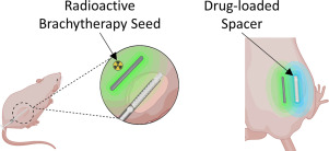 Continuous liquid interface production of 3D printed drug-loaded spacers to improve prostate cancer brachytherapy treatment