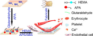 Dual-crosslinked bioprosthetic heart valves prepared by glutaraldehyde crosslinked pericardium and poly-2-hydroxyethyl methacrylate exhibited improved antithrombogenicity and anticalcification properties