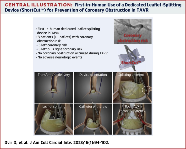 First-in-Human Dedicated Leaflet Splitting Device for Prevention of Coronary Obstruction in Transcatheter Aortic Valve Replacement