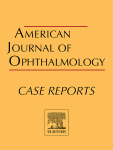 Acute macular neuroretinopathy secondary to central retinal artery occlusion