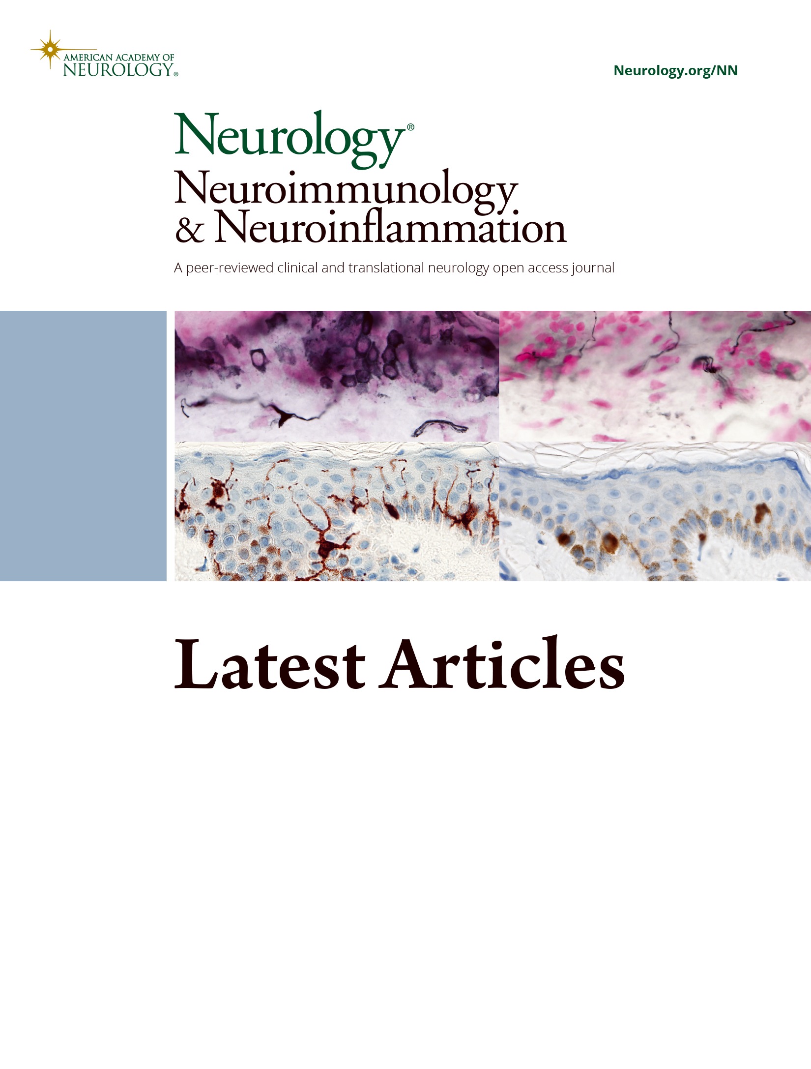Reduced Number of Thymoma CTLA4-Positive Cells Is Associated With a Higher Probability of Developing Myasthenia Gravis