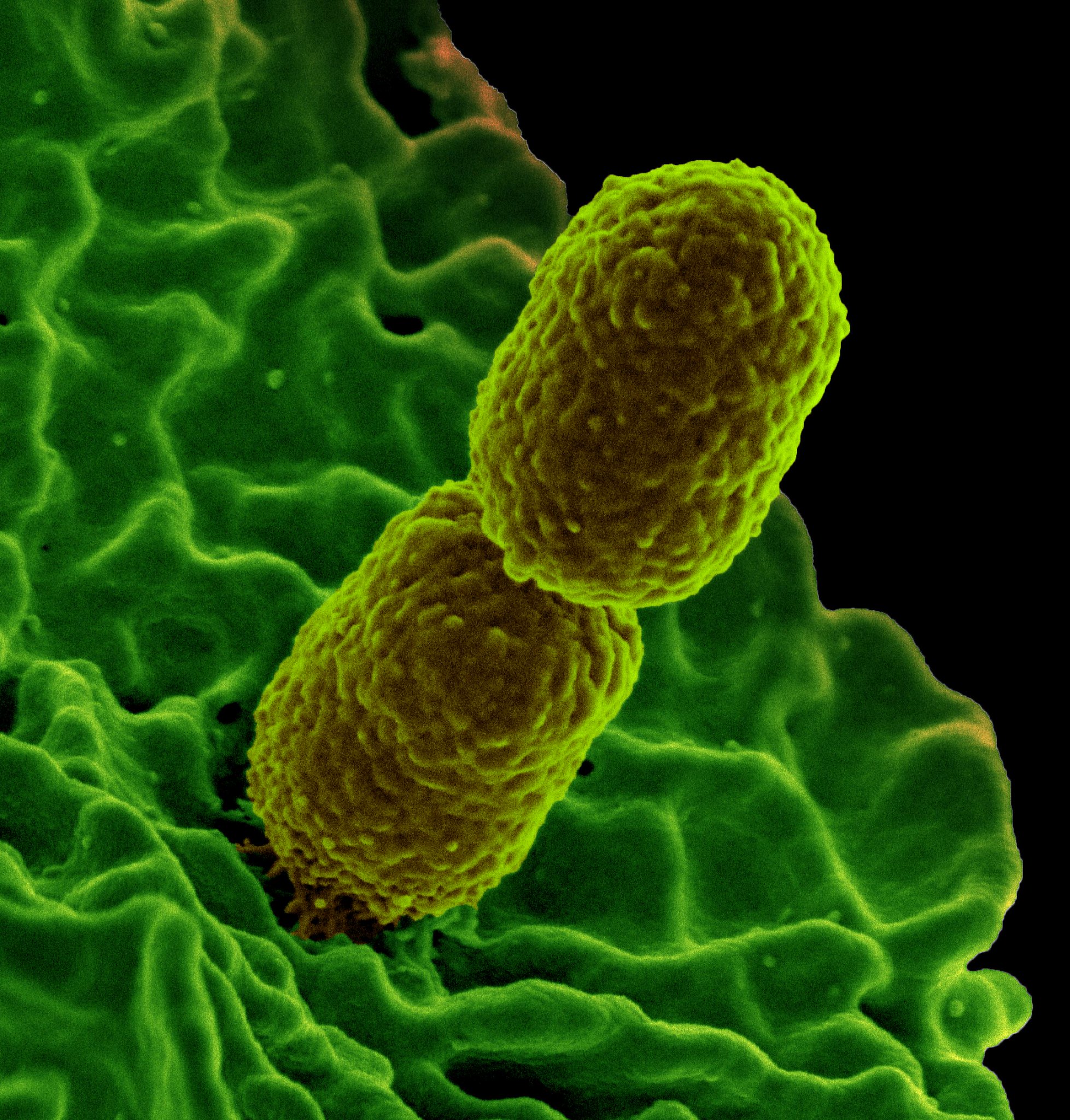 NIH scientists identify nutrient that helps prevent bacterial infection
