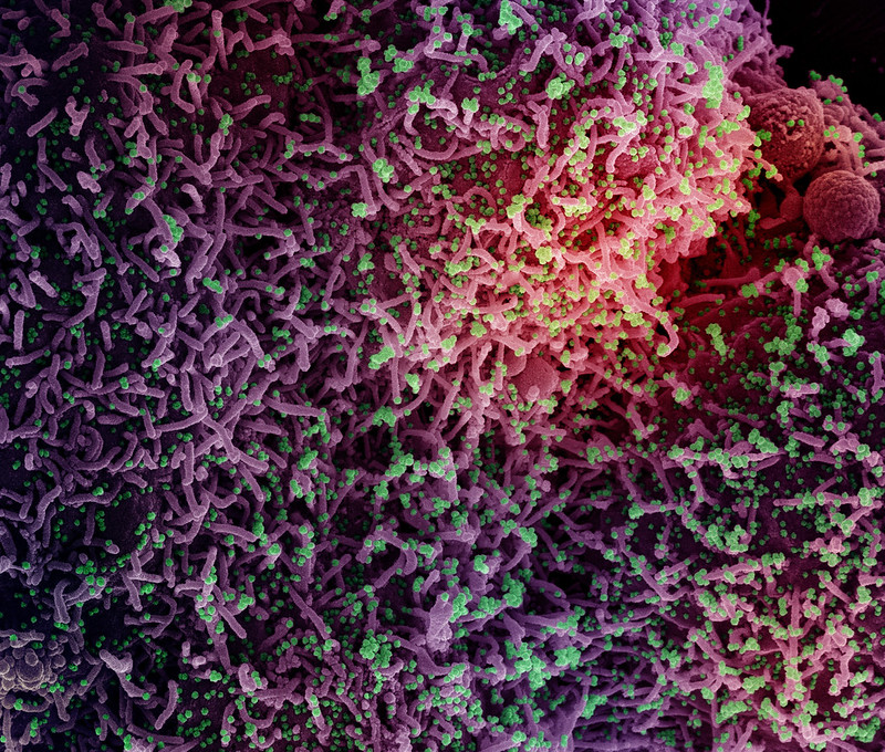 Food allergy is associated with lower risk of SARS-CoV-2 infection