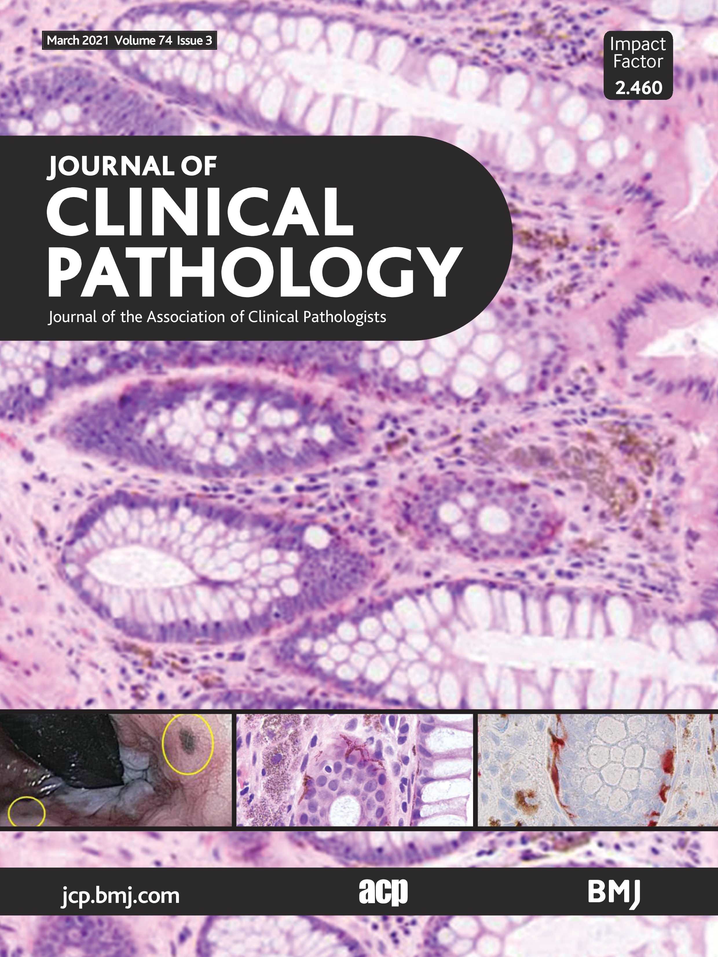Performance evaluation of a fully closed real-time PCR platform for the detection of KRAS p.G12C mutations in liquid biopsy of patients with non-small cell lung cancer