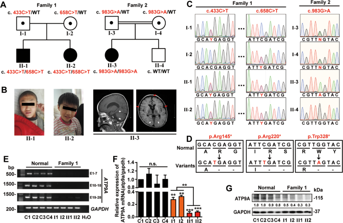 ATP9A deficiency causes ADHD and aberrant endosomal recycling via modulating RAB5 and RAB11 activity - Molecular Psychiatry