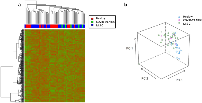 Pathophysiological pathway differences in children who present with COVID-19 ARDS compared to COVID -19 induced MIS-C - Nature Communications