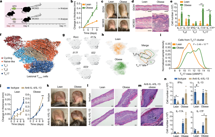 Obesity alters pathology and treatment response in inflammatory disease - Nature
