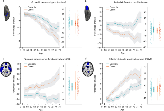 SARS-CoV-2 is associated with changes in brain structure in UK Biobank - Nature