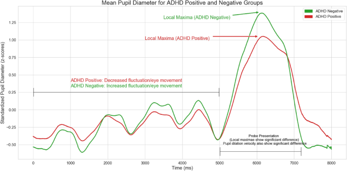 A Robust Machine Learning Based Framework for the Automated Detection of ADHD Using Pupillometric Biomarkers and Time Series Analysis - Scientific Reports