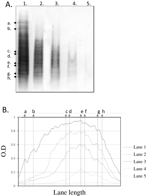 High prevalence of intrathecal IgA synthesis in multiple sclerosis patients - Scientific Reports