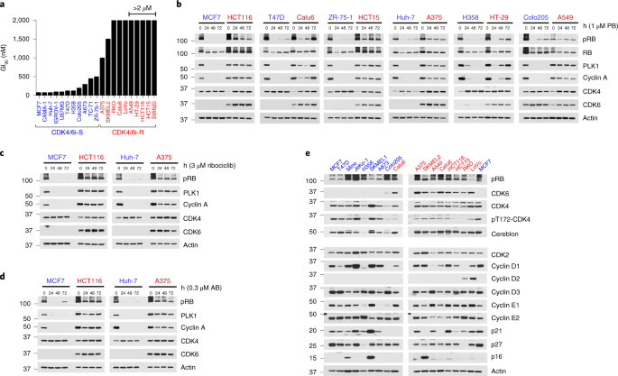 Distinct CDK6 complexes determine tumor cell response to CDK4/6 inhibitors and degraders