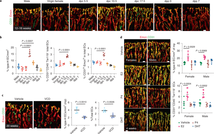 Estrogen enforces the integrity of blood vessels in the bone during pregnancy and menopause - Nature Cardiovascular Research