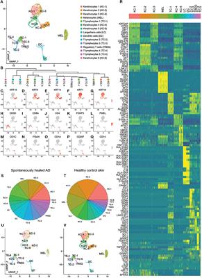 Spontaneously Resolved Atopic Dermatitis Shows Melanocyte and Immune Cell Activation Distinct From Healthy Control Skin