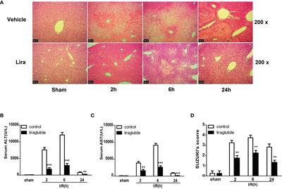 Liraglutide Attenuates Hepatic Ischemia-Reperfusion Injury by Modulating Macrophage Polarization