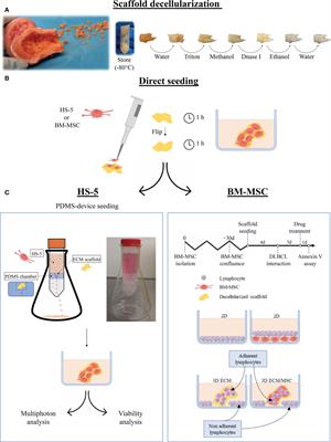 A bone-based 3D scaffold as an in-vitro model of microenvironment-DLBCL lymphoma cell interaction