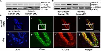 Empagliflozin prevents neointima formation by impairing smooth muscle cell proliferation and accelerating endothelial regeneration