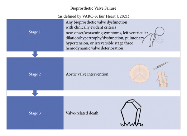 Management of Failed Bioprosthetic Aortic Valves: Mitigating Complications and Optimizing Outcomes