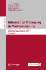 Weakly Supervised Deep Learning for Aortic Valve Finite Element Mesh Generation from 3D CT Images