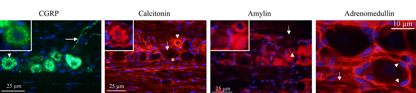 Biological and small molecule strategies in migraine therapy with relation to the CGRP family of peptides.
