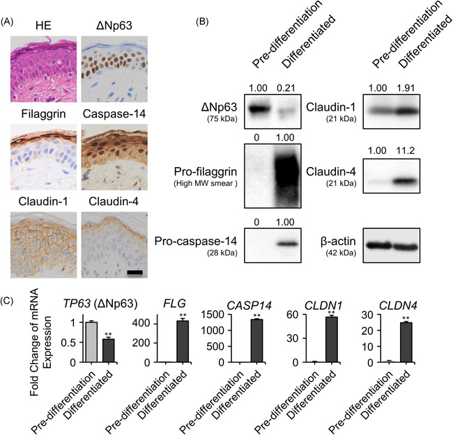 IL-13 modulates ∆Np63 levels causing altered expression of barrier- and inflammation-related molecules in human keratinocytes: A possible explanation for chronicity of atopic dermatitis.