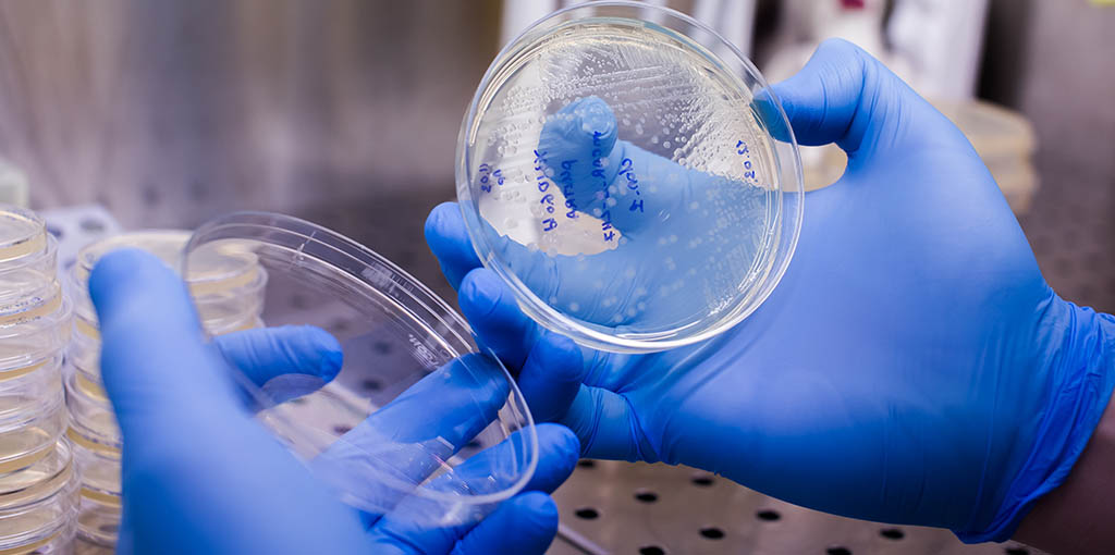 Evading exhaustion to improve CAR-T cell therapy - Scope