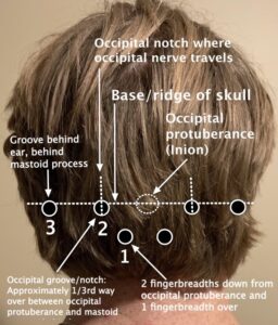 Occipital Neuralgia Pain in the Back of the Head, Treatments, and Block