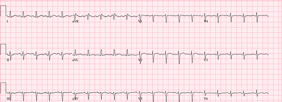 What Works for One May Not Work for Another: A New Warning for Modafinil