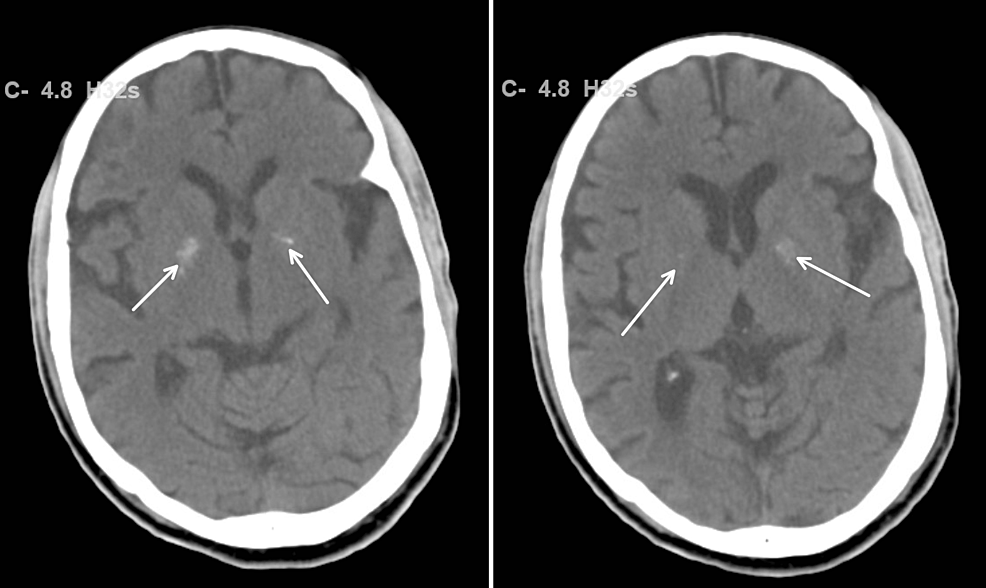 False-Positive Human Immunodeficiency Virus Results in COVID-19 Patients
