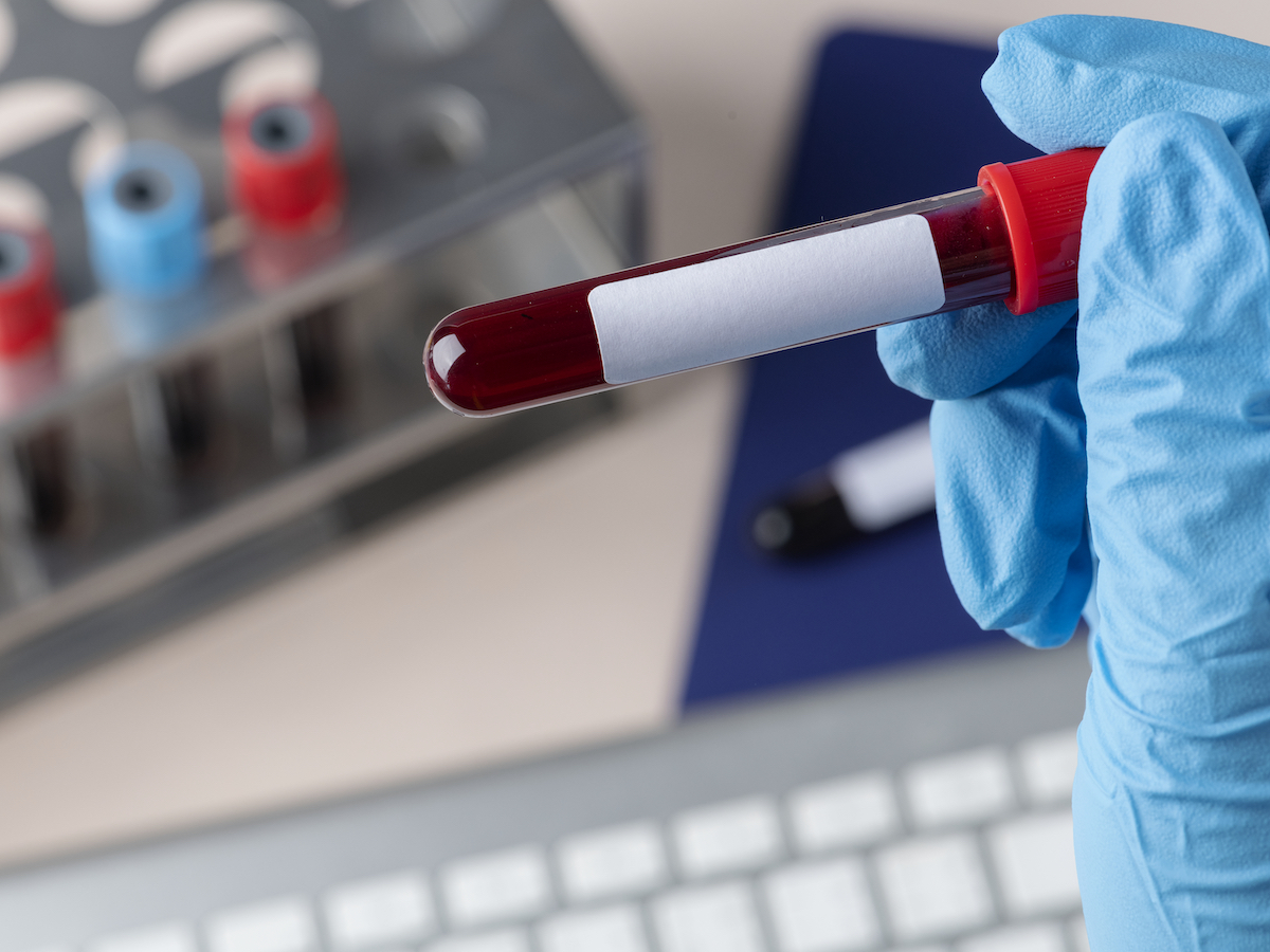 Regular Testing of HIV and Sexually Transmitted Infections With Self-Collected Samples From Multiple Anatomic Sites to Monitor Sexual Health in Men Who Have Sex With Men: Longitudinal Study