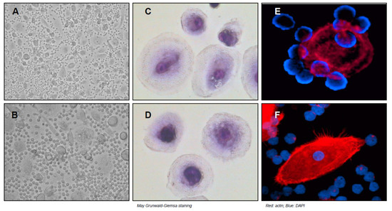 Nurse-Like Cells and Chronic Lymphocytic Leukemia B Cells: A Mutualistic Crosstalk inside Tissue Microenvironments