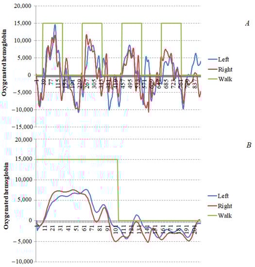 Motor Cortical Activation Assessment in Progressive Multiple Sclerosis Patients Enrolled in Gait Rehabilitation: A Secondary Analysis of the RAGTIME Trial Assisted by Functional Near-Infrared Spectroscopy