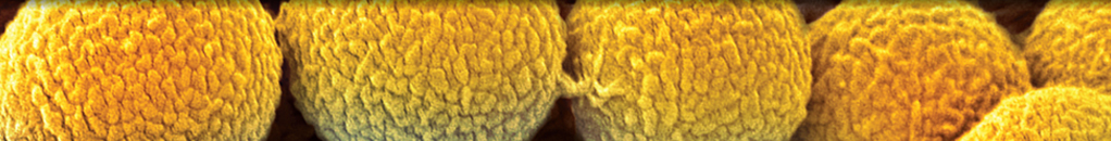 Contribution of Patch Tests with Occupational Handled Products in the Diagnosis of Occupational Contact Dermatitis: A 10-year Review