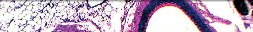 Patients with Dipper and Nondipper High-Normal Blood Pressure Were Associated with Left Ventricular Mass