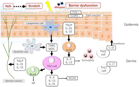 Involvement of Atopic Dermatitis in the Development of Systemic Inflammatory Diseases