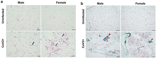 Susceptibility of Fat Tissue to SARS-CoV-2 Infection in Female hACE2 Mouse Model