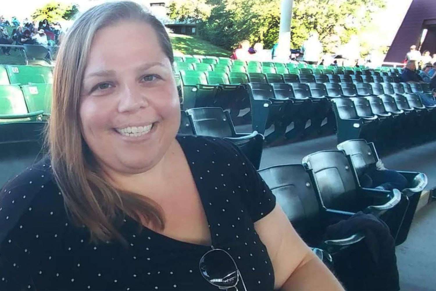 TODAY: Misdiagnosed as Cancer, Woman Has Watermelon-Sized Uterine Fibroid Removed