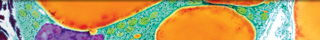 Current Management Guidelines on Hyperlipidemia: The Silent Killer