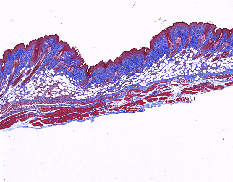 NF-κB perturbation reveals unique immunomodulatory functions in Prx1+ fibroblasts that promote development of atopic dermatitis