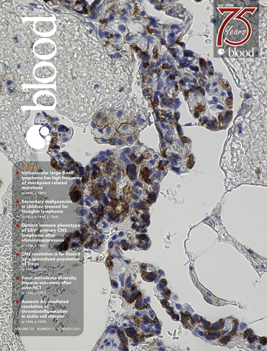 Targeting the Otub1/c-Maf axis for the treatment of multiple myeloma