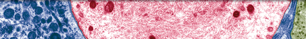 Pulmonary Function and Respiratory Muscle Strength in Patients with Multiple Sclerosis