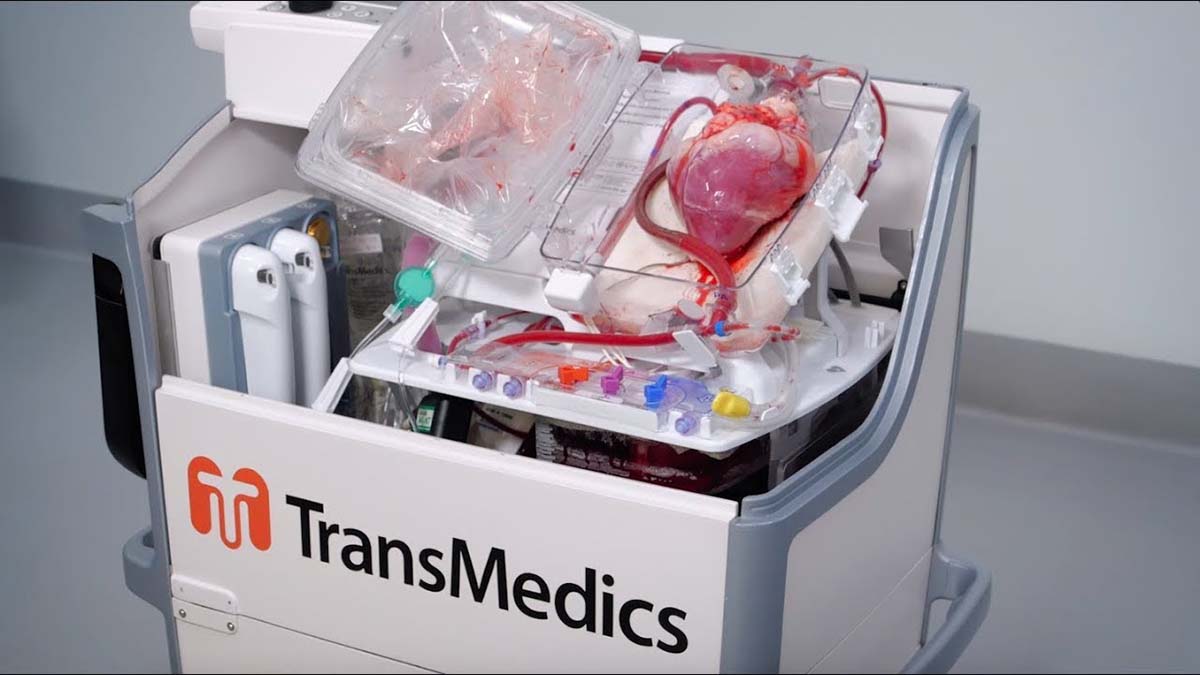 Panel Back On Track For TransMedics’ Heart Device After Missing A Few Beats