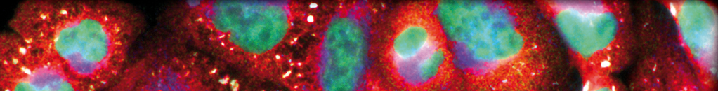 Nicotinamide Mononucleotide Ameliorates Cellular Senescence and Inflammation Caused by Sodium Iodate in RPE
