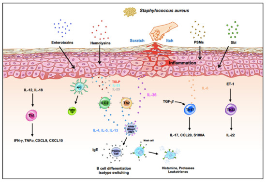 Immunomodulatory Role of Staphylococcus aureus in Atopic Dermatitis