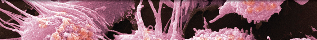 MRI-Based Radiotherapy Planning to Reduce Rectal Dose in Excess of Tolerance