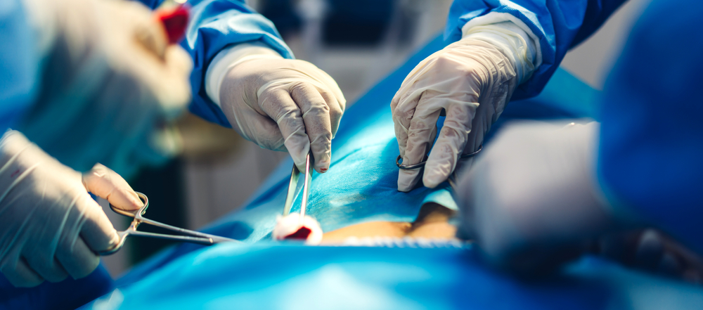 Core outcomes defined for studies of uterus-sparing interventions in uterine adenomyosis